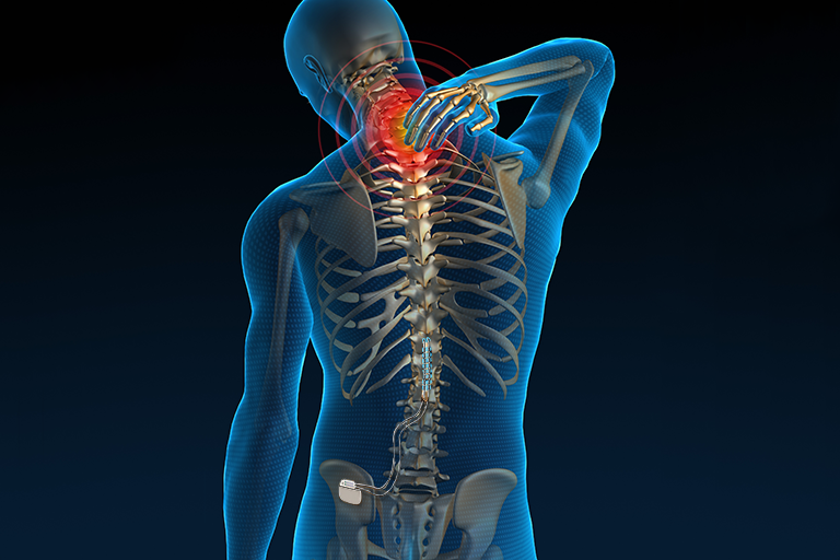 spinal cord stimulation with dr. travis washington